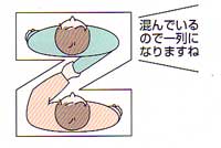 ̏ꍇ̃CXg
